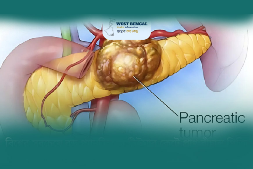 Government hospital in Bengal performs a rare digestive organ surgery – GetBengal story