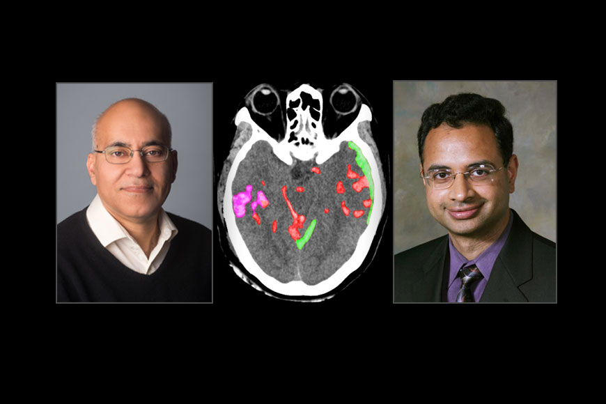 Bengali scientist Pratik Mukherjee’s AI to detect brain haemorrhage in seconds and save lives!