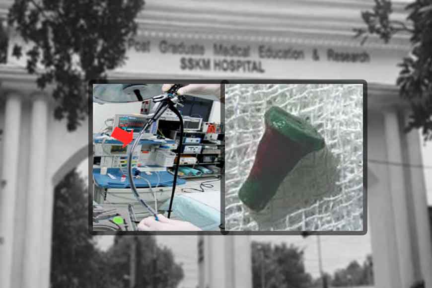 Doctors of SSKM Hospital perform rare surgery to save boy